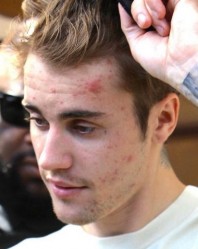 Justin Bieber