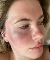 Ireland Basinger Baldwin