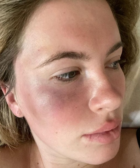 Ireland Basinger Baldwin