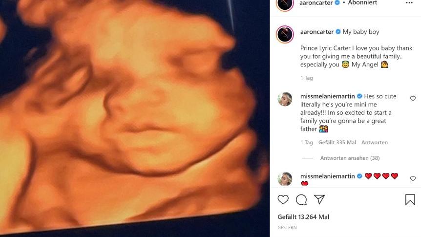 aaron-carter-teilt-ultraschallfoto-ist-er-schon-papa-geworden
