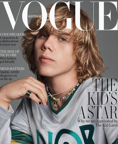 The Kid Laroi @ "Vogue"