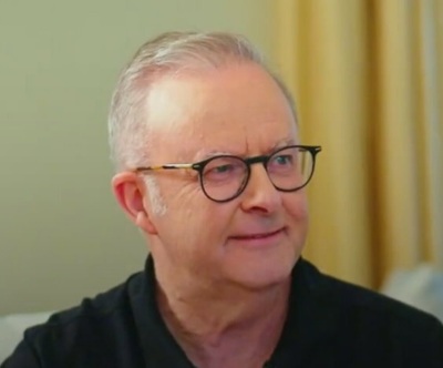 Anthony Albanese
