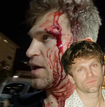 Keegan Allen